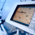 Home Sleep Studies in Brisbane: Get Tested Without Leaving Your Bed